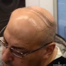 s3pp0bald3rs