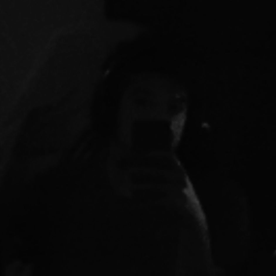 Kevcio__
