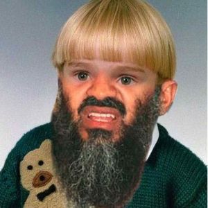 B3nz0n